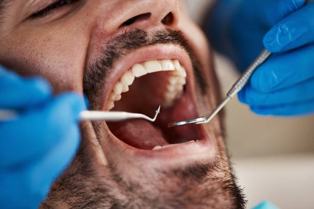 Best Cracked Tooth Emergency Dentist  in Royal City, WA